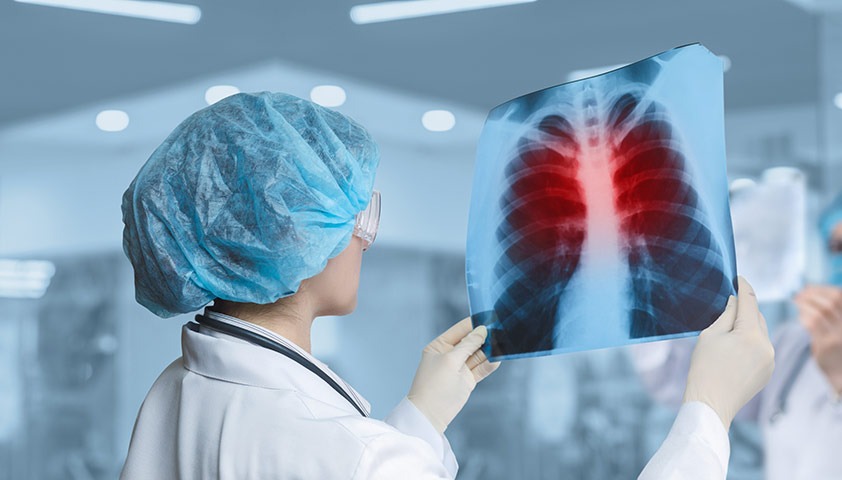منظمة الصحة العالمية: التقدم العالمي في مكافحة السل مهدد بسبب نقص التمويل